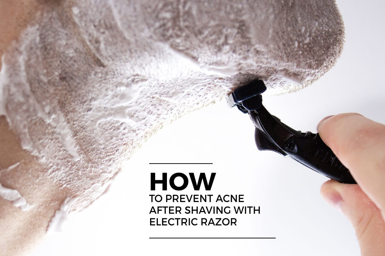 how to prevent acne after shaving with electric razor (1)